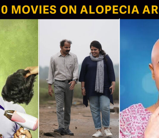 Top 10 movies on Alopecia Areata